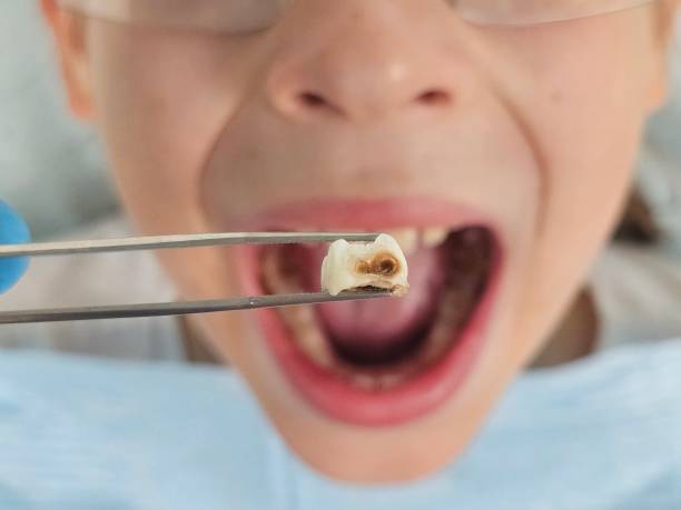 Best Urgent Tooth Repair  in Humboldt, TN