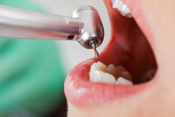 Best Emergency Dental Filling Replacement  in Humboldt, TN